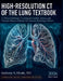 High-Resolution CT of the Lung Textbook: A Clinical Reference Covering Interstitial, Airway, and Vascular Disease Patterns for Thoracic Radiology Fell by Anthony S. Houle