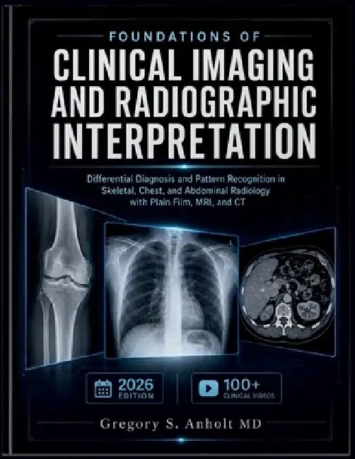 Foundations of Clinical Imaging and Radiographic Interpretation: Differential Diagnosis and Pattern Recognition in Skeletal, Chest, and Abdominal Radi by Gregory S. Anholt