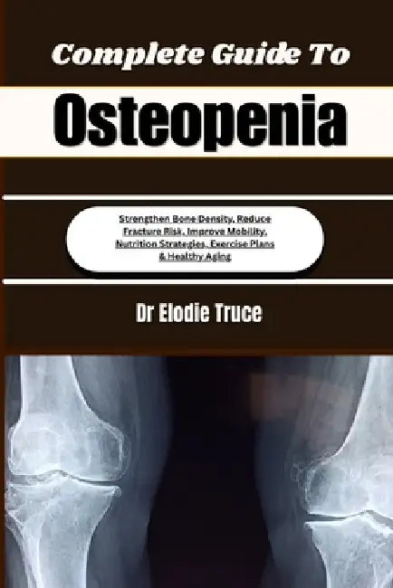 Complete Guide To Osteopenia: Strengthen Bone Density, Reduce Fracture Risk, Improve Mobility, Nutrition Strategies, Exercise Plans & Healthy Aging by Elodie Truce
