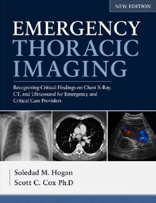 Emergency Thoracic Imaging: Recognizing Critical Findings on Chest X-Ray, CT, and Ultrasound for Emergency and Critical Care Providers. by Scott C. Cox Ph. D., Soledad M. Hogan