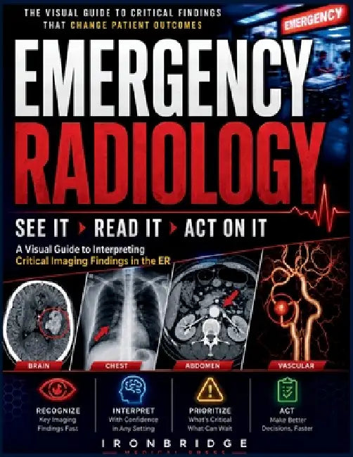 Emergency Radiology: See It, Read It, Act On It: A Visual Guide to Interpreting Critical Imaging Findings in the ER by Ironbridge Medical Press