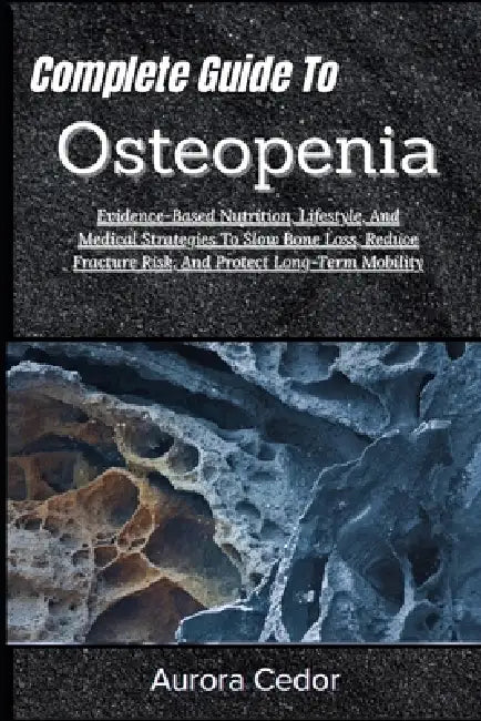 Complete Guide To Osteopenia: Evidence-Based Nutrition, Lifestyle, And Medical Strategies To Slow Bone Loss, Reduce Fracture Risk, And Protect Long-Te by Aurora Cedor