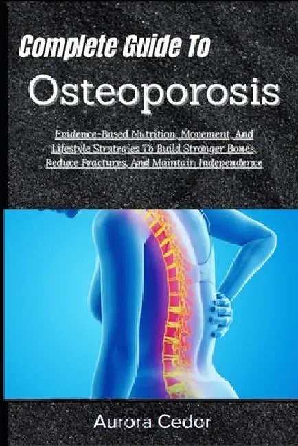 Complete Guide To Osteoporosis: Evidence-Based Nutrition, Movement, And Lifestyle Strategies To Build Stronger Bones, Reduce Fractures, And Maintain I by Aurora Cedor