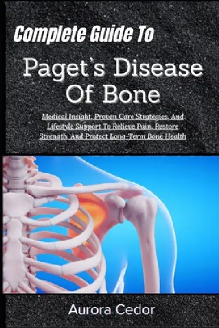 Complete Guide To Paget's Disease Of Bone: Medical Insight, Proven Care Strategies, And Lifestyle Support To Relieve Pain, Restore Strength, And Prote by Aurora Cedor