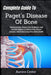 Complete Guide To Paget's Disease Of Bone: Medical Insight, Proven Care Strategies, And Lifestyle Support To Relieve Pain, Restore Strength, And Prote by Aurora Cedor