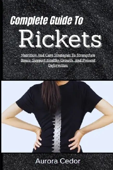 Complete Guide To Rickets: Nutrition And Care Strategies To Strengthen Bones, Support Healthy Growth, And Prevent Deformities by Aurora Cedor