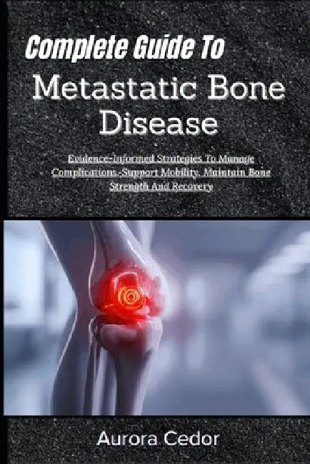 Complete Guide To Metastatic Bone Disease: Evidence-Informed Strategies To Manage Complications, Support Mobility, Maintain Bone Strength And Recovery by Aurora Cedor