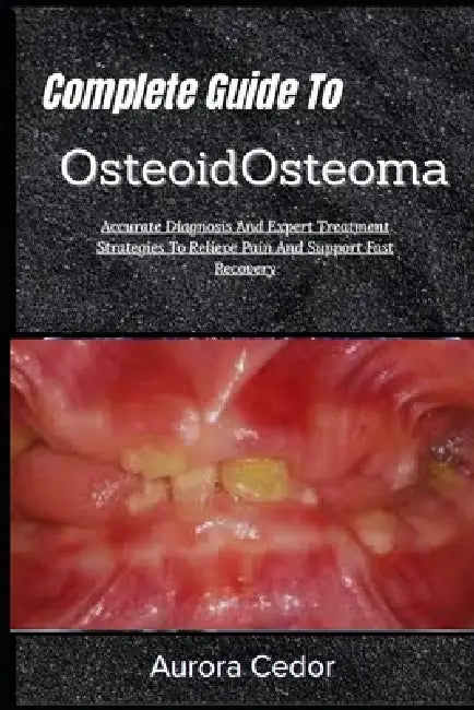 Complete Guide To OsteoidOsteoma: Accurate Diagnosis And Expert Treatment Strategies To Relieve Pain And Support Fast Recovery by Aurora Cedor