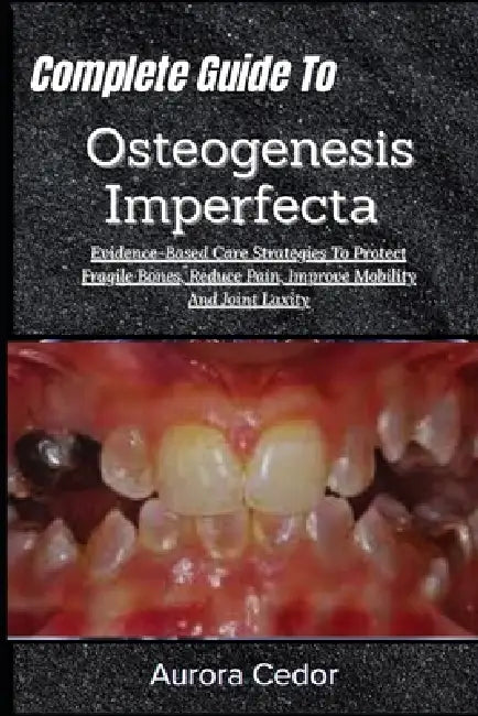 Complete Guide To Osteogenesis Imperfecta: Evidence-Based Care Strategies To Protect Fragile Bones, Reduce Pain, Improve Mobility And Joint Laxity by Aurora Cedor