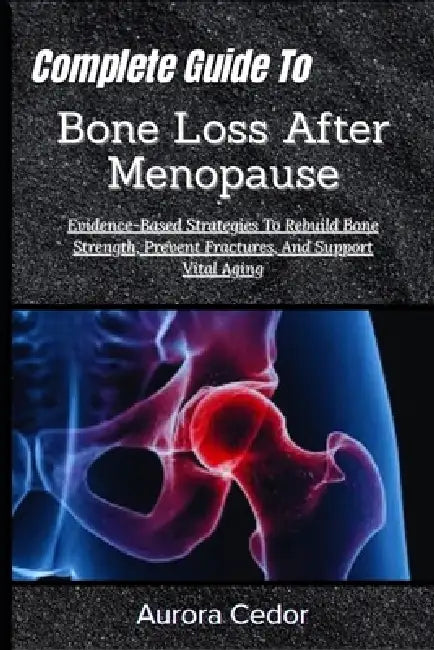 Complete Guide To Bone Loss After Menopause: Evidence-Based Strategies To Rebuild Bone Strength, Prevent Fractures, And Support Vital Aging by Aurora Cedor