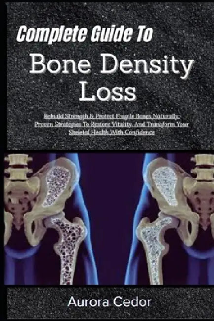 Complete Guide To Bone Density Loss: Rebuild Strength & Protect Fragile Bones Naturally: Proven Strategies To Restore Vitality, And Transform Your Ske by Aurora Cedor