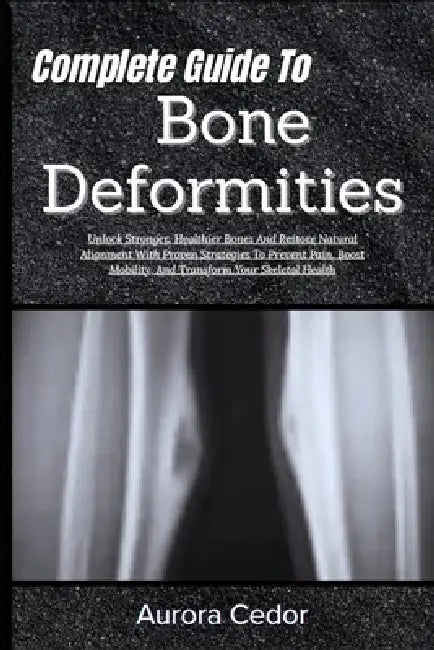 Complete Guide To Bone Deformities: Unlock Stronger, Healthier Bones And Restore Natural Alignment With Proven Strategies To Prevent Pain, Boost Mobil by Aurora Cedor