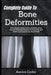 Complete Guide To Bone Deformities: Unlock Stronger, Healthier Bones And Restore Natural Alignment With Proven Strategies To Prevent Pain, Boost Mobil by Aurora Cedor
