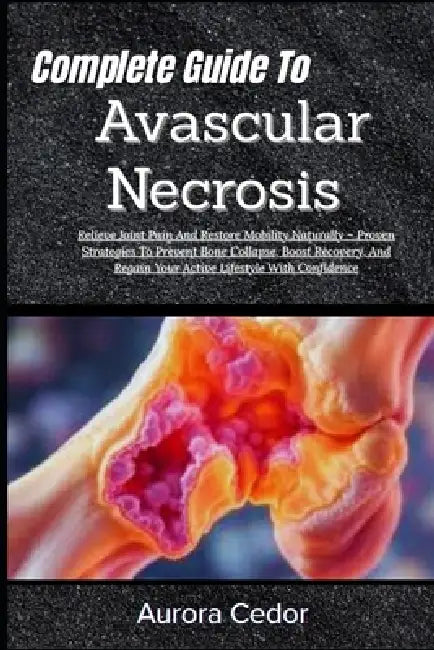 Complete Guide To Avascular Necrosis: Relieve Joint Pain And Restore Mobility Naturally - Proven Strategies To Prevent Bone Collapse, Boost Recovery, by Aurora Cedor