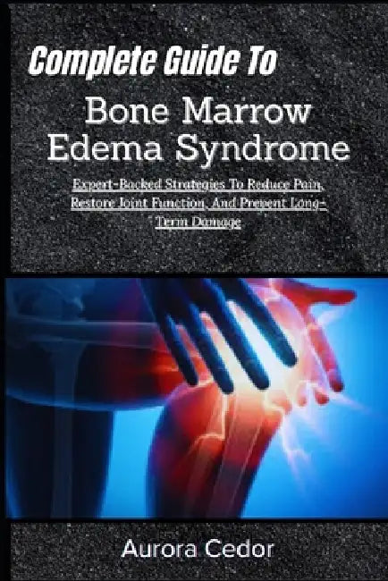 Complete Guide To Bone Marrow Edema Syndrome: Expert-Backed Strategies To Reduce Pain, Restore Joint Function, And Prevent Long-Term Damage by Aurora Cedor