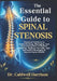The Essential Guide to Spinal Stenosis: Practical Solutions to Understanding, Managing, and Overcoming Pain to Restore Mobility, Reclaim Your Life, an by Caldwell Harrison