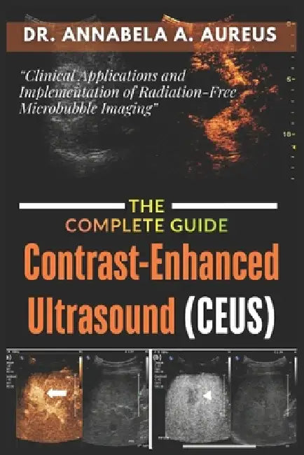 Contrast-Enhanced Ultrasound (CEUS): The Complete Guide: Clinical Applications and Implementation of Radiation-Free Microbubble Imaging by Annabela A. Aureus