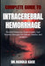 Complete Guide To Intracerebral Hemorrhage: Practical Treatments, Expert Insights, And Recovery Strategies For Patients, Families, And Caregivers by Dr Harold Kace