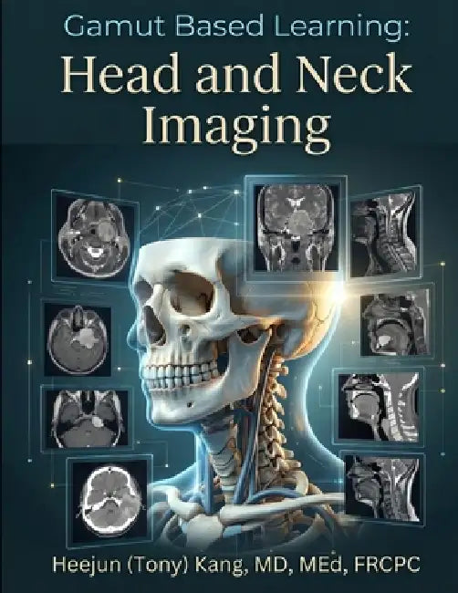 Gamut Based Learning: Head and Neck Imaging by Heejun (Tony) Kang