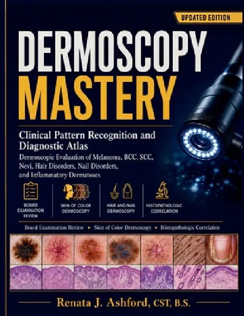 Dermoscopy Mastery: Clinical Pattern Recognition and Diagnostic Atlas by Renata J. Ashford B. S.