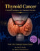 Thyroid Cancer: Principles, Strategies, and Therapeutic Precision by Richi Sinha, Mihir Chandrayan, Rakesh Kumar Singh