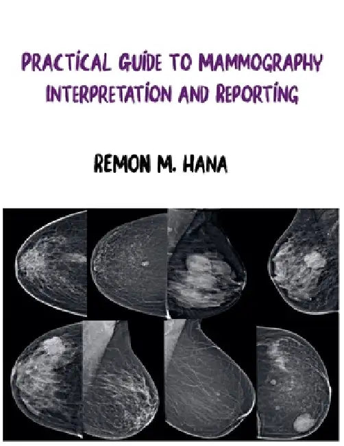 Practical Guide to Mammography Interpretation and Reporting by Remon M. Hana