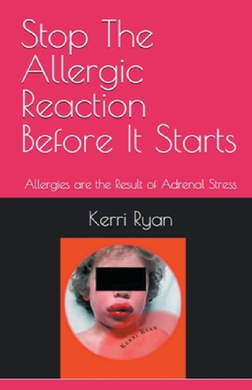 Stop the Allergic Reaction Before It Starts by Kerri Ryan