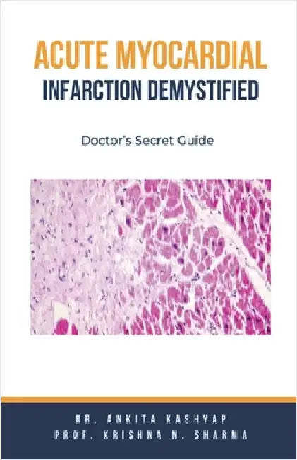 Acute Myocardial Infarction Demystified: Doctor's Secret Guide by Ankita Kashyap