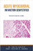 Acute Myocardial Infarction Demystified: Doctor's Secret Guide by Ankita Kashyap