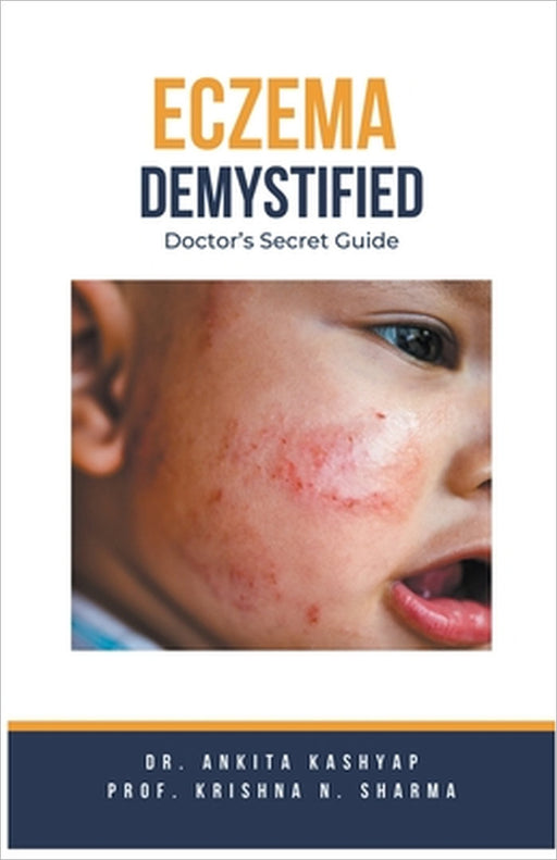 Eczema Demystified: Doctor's Secret Guide by Ankita Kashyap, Prof Krishna N. Sharma