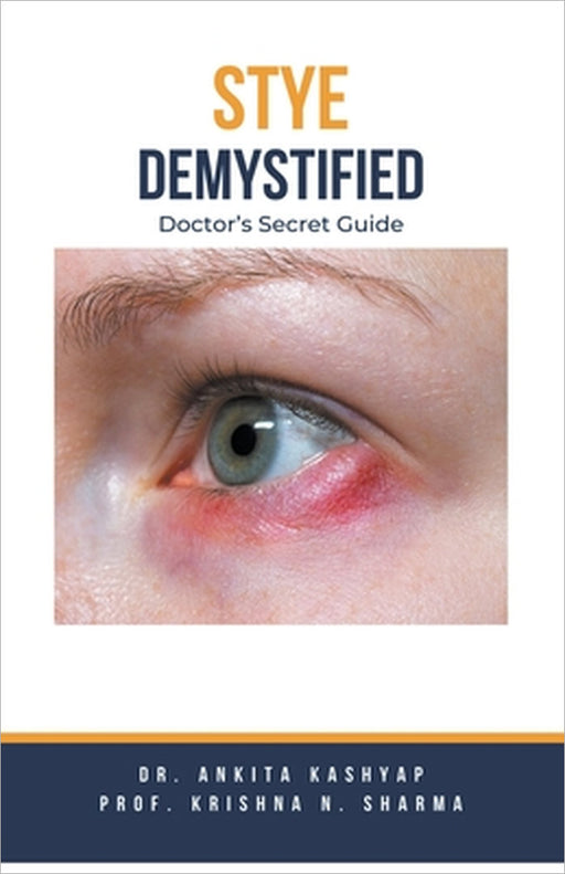 Stye Demystified: Doctor's Secret Guide by Ankita Kashyap, Prof Krishna N. Sharma