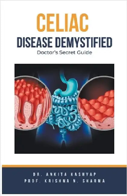 Celiac Disease Demystified: Doctor's Secret Guide by Kashyap, Ankita