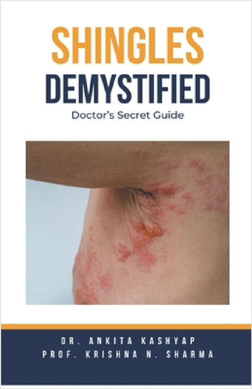 Shingles Demystified: Doctor's Secret Guide by Ankita Kashyap, Prof Krishna N. Sharma
