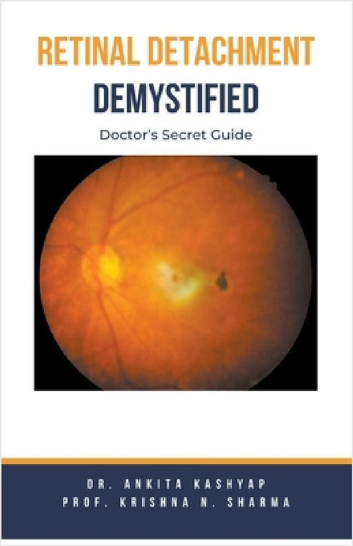 Retinal Detachment Demystified: Doctor's Secret Guide by Ankita Kashyap, Prof Krishna N. Sharma