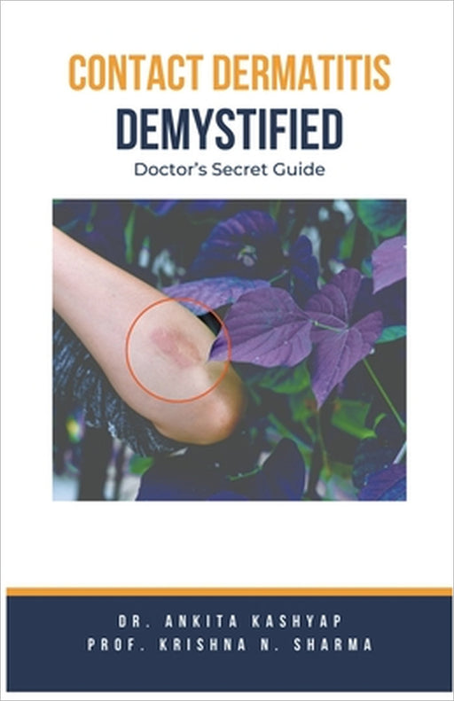 Contact Dermatitis Demystified: Doctor's Secret Guide by Ankita Kashyap, Prof Krishna N. Sharma