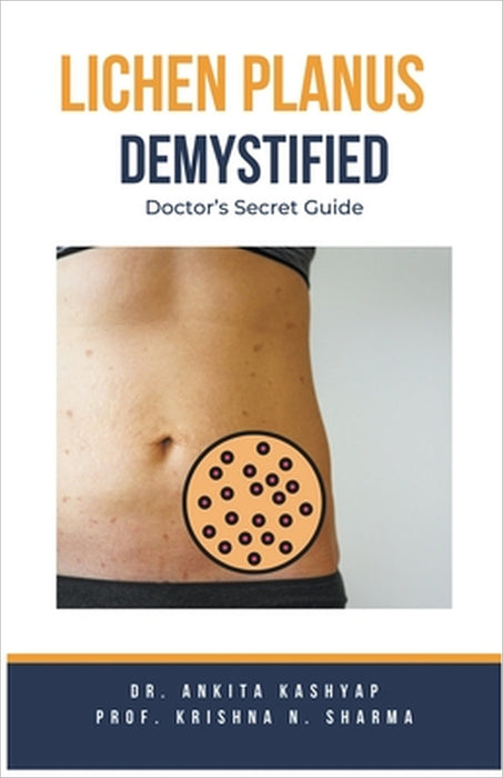 Lichen Planus Demystified Doctors Secret Guide by Ankita Kashyap, Prof Krishna N. Sharma