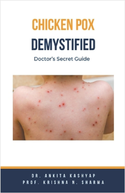 Chickenpox Demystified: Doctor's Secret Guide by Ankita Kashyap, Prof Krishna N. Sharma