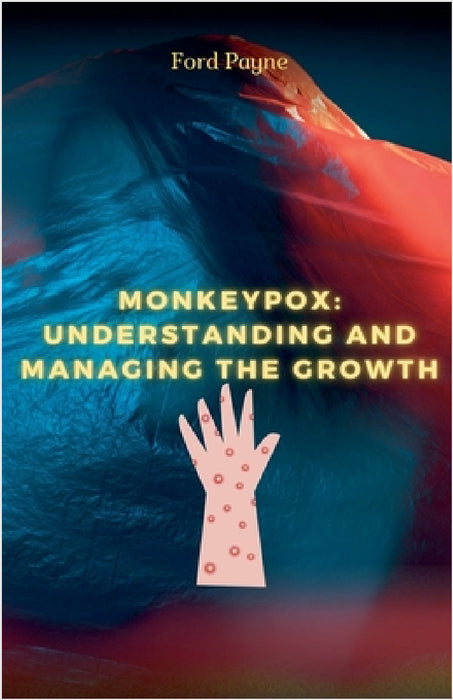 Monkeypox: Understanding And Managing The Growth by Ford Payne