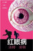 红眼病 by Tom Norton