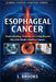 Esophageal Cancer: Understanding, Treating, and Living Beyond One of the World's Deadliest Cancers by Lydia Brooks
