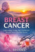 Breast Cancer: Understanding, Treating, and Living Beyond One of the World's Most Common Cancers by Lydia Brooks