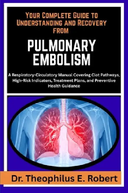 Your Complete Guide to Understanding and Recovery from Pulmonary Embolism: A Respiratory-Circulatory Manual Covering Clot Pathways, High-Risk Indicato by Theophilus E. Robert
