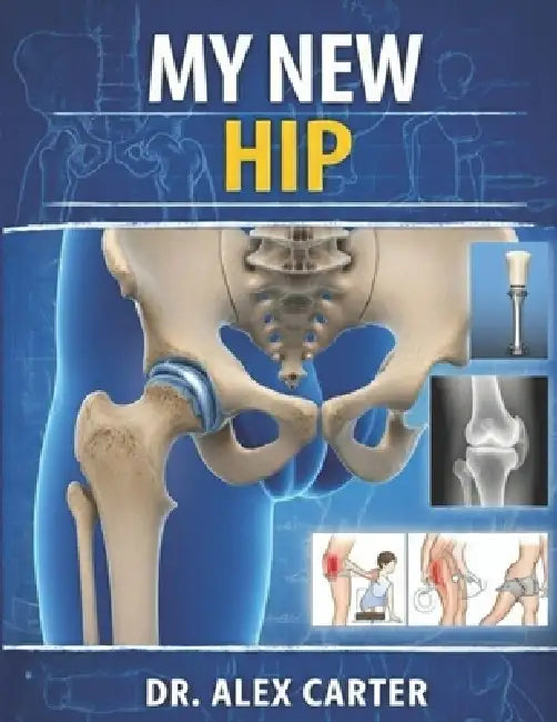 My New Hip: The Complete Guide to Hip Replacement Surgery, Recovery, Rehab, Pain Relief, Exercises, and Regaining Mobility by Alex Carter