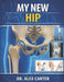 My New Hip: The Complete Guide to Hip Replacement Surgery, Recovery, Rehab, Pain Relief, Exercises, and Regaining Mobility by Alex Carter