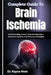 Complete Guide To Brain Ischemia: Understanding Causes, Early Warning Signs, Treatment Options, And Recovery Strategies by Kayce Noel