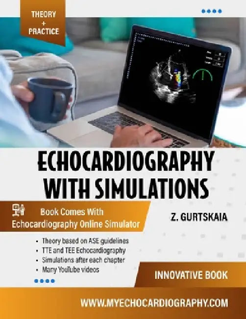 Echocardiography With Simulations by Zviad Gurtskaia