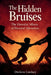 The Hidden Bruises: When Psychological Pain Becomes Physical by Dwilene Lindsey