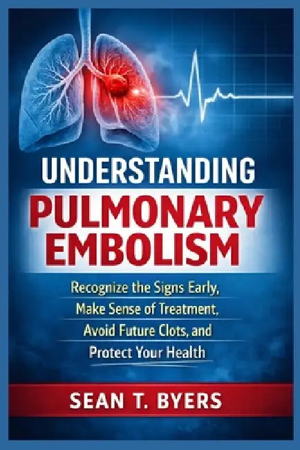 Understanding Pulmonary Embolism: Recognize the Signs Early, Make Sense of Treatment, Avoid Future Clots, and Protect Your Health by Sean T. Byers