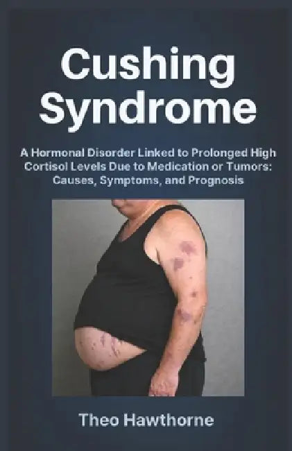 Cushing Syndrome: A Hormonal Disorder Linked to Prolonged High Cortisol Levels Due to Medication or Tumors: Causes, Symptoms, and Prognosis by Theo Hawthorne