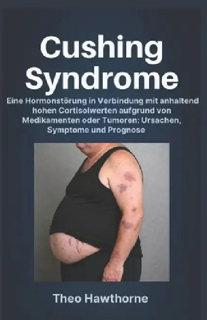 Cushing Syndrome: Eine Hormonstörung in Verbindung mit anhaltend hohen Cortisolwerten aufgrund von Medikamenten oder Tumoren: Ursachen, Symptome und P by Theo Hawthorne